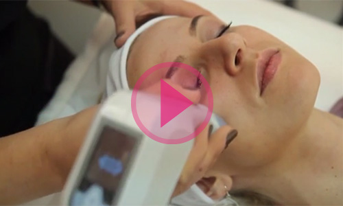 exilis facelifting video