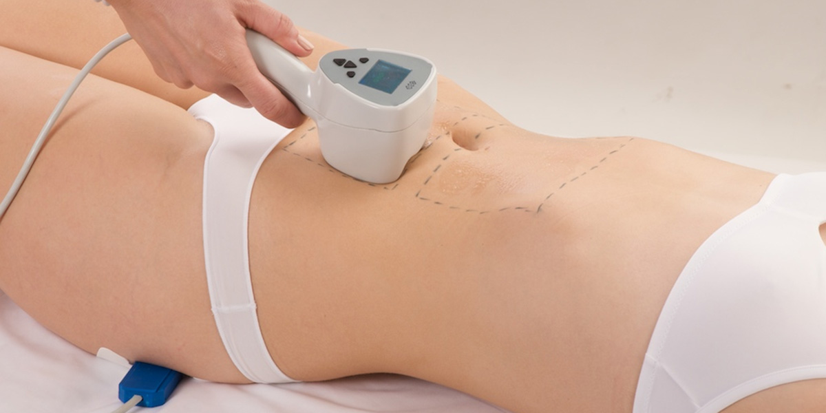 Exilis | Alternativna, neinvazivna liposukcija